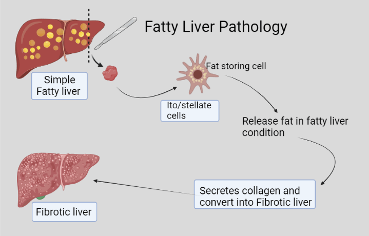 Fatty Liver Grades
