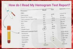 Hemogram Test