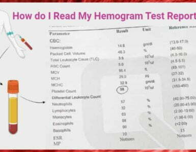 Hemogram Test