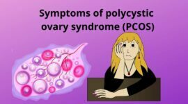 symptoms of polycystic ovary syndrome