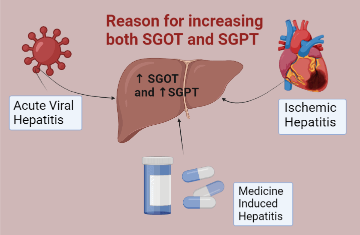 SGOT and SGPT in Liver Function Test 