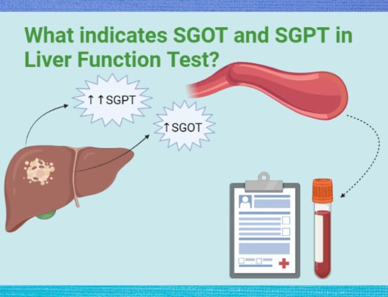 SGPT in Liver Function Test