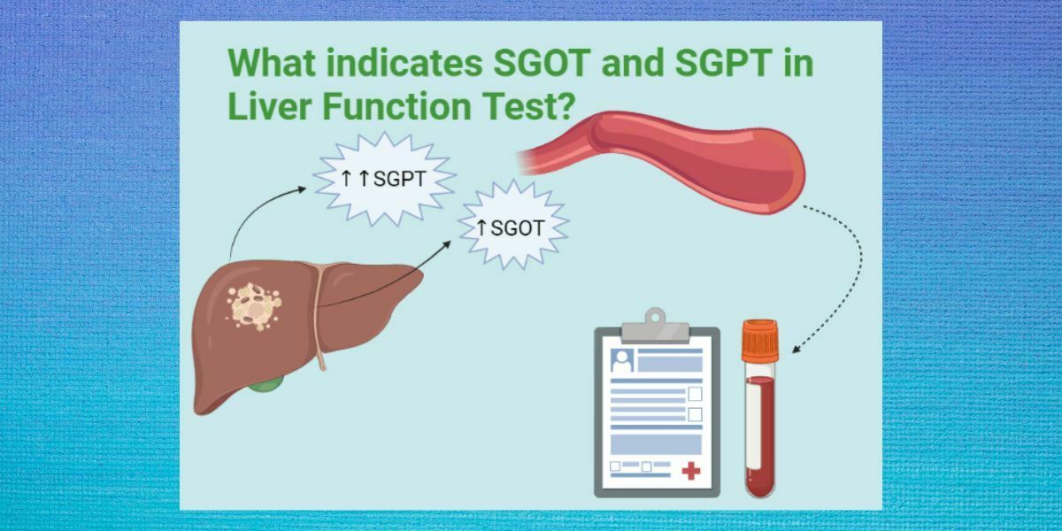 SGPT in Liver Function Test
