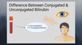 conjugated and unconjugated bilirubin